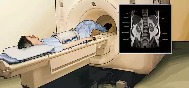 MRI Scan of the Abdomen: Purpose, Process, and Outcome